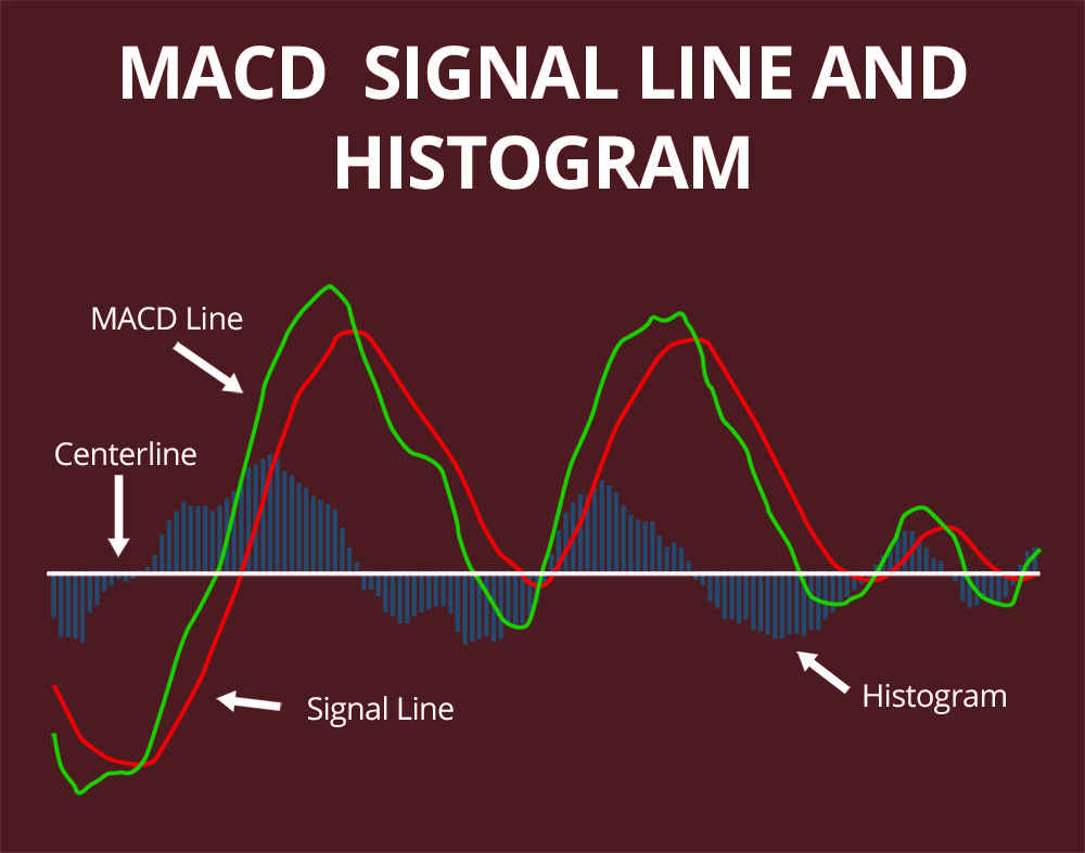 What Is the MACD
